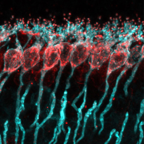 Bipolar cells labeled for PKCα (cyan) and TRPM1 (red)