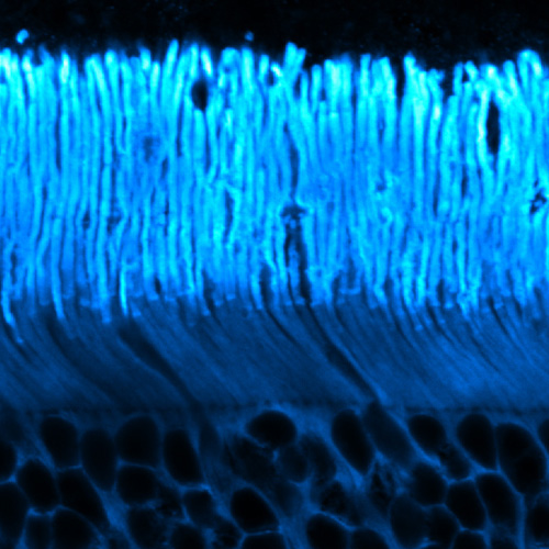 Photoreceptors labeled with transducin antibody