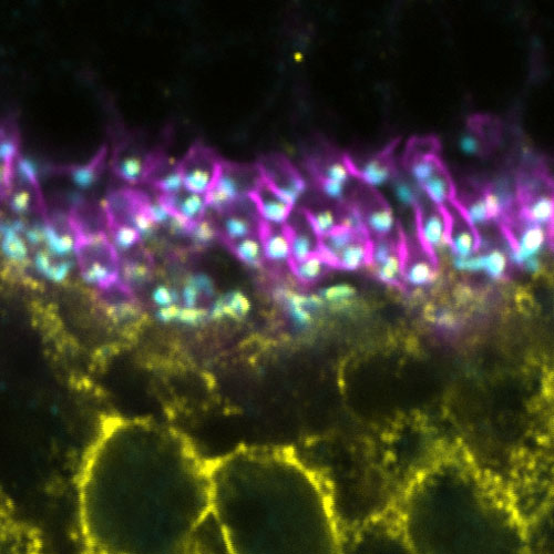 Photoreceptor-ON BC synapses labeled with antibodies for PSD95 (magenta), ELFN1 (cyan), and TRPM1 (yellow)