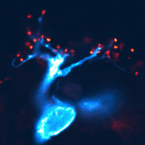 Bipolar cell expressing electroporated mEmerald-Sec61 and labeled with mGluR6 antibody